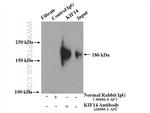 KIF14 Antibody in Immunoprecipitation (IP)