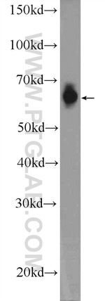 FAM116B Antibody in Western Blot (WB)