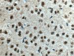 DLX2 Antibody in Immunohistochemistry (Paraffin) (IHC (P))