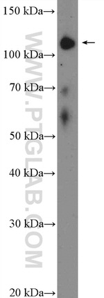 TAOK1 Antibody in Western Blot (WB)