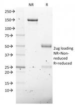 NKX2.8 Antibody in SDS-PAGE (SDS-PAGE)