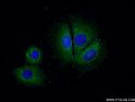 CCM2 Antibody in Immunocytochemistry (ICC/IF)