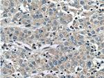 CCM2 Antibody in Immunohistochemistry (Paraffin) (IHC (P))