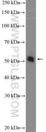 CCM2 Antibody in Western Blot (WB)