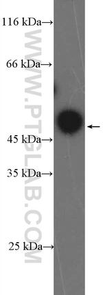 ZNF385A Antibody in Western Blot (WB)