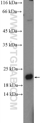 C1orf93 Antibody in Western Blot (WB)