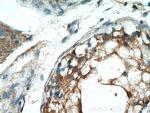 PDILT Antibody in Immunohistochemistry (Paraffin) (IHC (P))