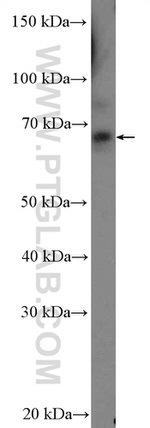 ZNF169 Antibody in Western Blot (WB)