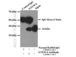 GTF3C6 Antibody in Immunoprecipitation (IP)