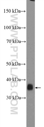 GTF3C6 Antibody in Western Blot (WB)