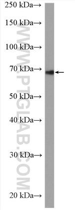 SLC5A6 Antibody in Western Blot (WB)