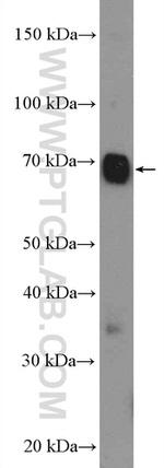 SLC5A6 Antibody in Western Blot (WB)