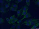 MC1R Antibody in Immunocytochemistry (ICC/IF)