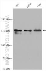 53BP2 Antibody in Western Blot (WB)