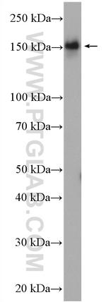 53BP2 Antibody in Western Blot (WB)