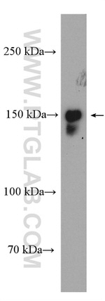 53BP2 Antibody in Western Blot (WB)