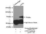 CPT2 Antibody in Immunoprecipitation (IP)