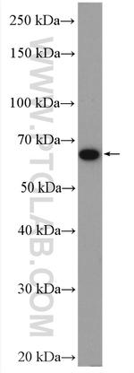 CPT2 Antibody in Western Blot (WB)