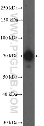 CPT2 Antibody in Western Blot (WB)