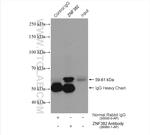 ZNF382 Antibody in Immunoprecipitation (IP)