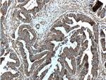 ST13 Antibody in Immunohistochemistry (Paraffin) (IHC (P))