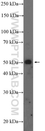 ST13 Antibody in Western Blot (WB)