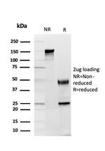 GDF8 (Growth Differentiation Factor 8)/Myostatin Antibody in SDS-PAGE (SDS-PAGE)