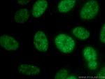 SMARCA2 Antibody in Immunocytochemistry (ICC/IF)