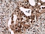 SMARCA2 Antibody in Immunohistochemistry (Paraffin) (IHC (P))