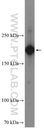 SMARCA2 Antibody in Western Blot (WB)