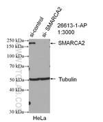 SMARCA2 Antibody in Western Blot (WB)