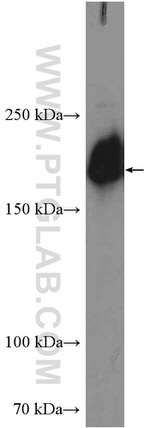 SMARCA2 Antibody in Western Blot (WB)