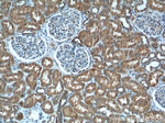 ALDH9A1 Antibody in Immunohistochemistry (Paraffin) (IHC (P))