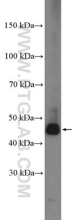 ALDH9A1 Antibody in Western Blot (WB)