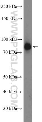P3H1 Antibody in Western Blot (WB)