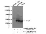 ENTPD5 Antibody in Immunoprecipitation (IP)
