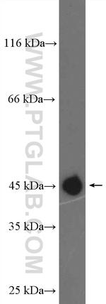ENTPD5 Antibody in Western Blot (WB)