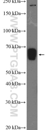 SLC22A7 Antibody in Western Blot (WB)