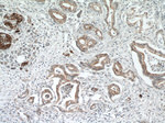 SLC25A12 Antibody in Immunohistochemistry (Paraffin) (IHC (P))