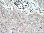 SLC25A12 Antibody in Immunohistochemistry (Paraffin) (IHC (P))