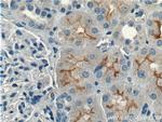 CLCN5 Antibody in Immunohistochemistry (Paraffin) (IHC (P))