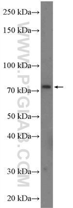 CLCN5 Antibody in Western Blot (WB)