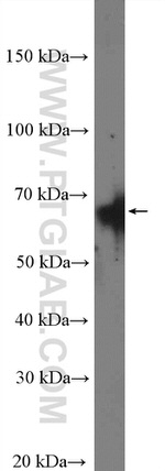 CstF-64 Antibody in Western Blot (WB)