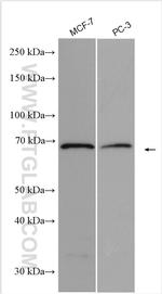 SLC22A16 Antibody in Western Blot (WB)