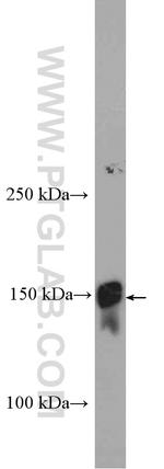 LTBP1 Antibody in Western Blot (WB)