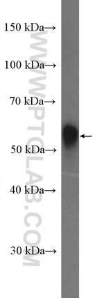 Perilipin 5 Antibody in Western Blot (WB)