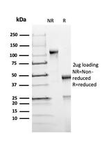 FOXP1 (Transcription Factor) Antibody in SDS-PAGE (SDS-PAGE)