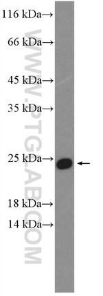 C17orf49 Antibody in Western Blot (WB)