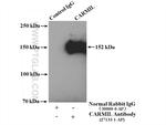 CARMIL Antibody in Immunoprecipitation (IP)