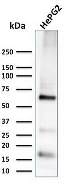 Glypican-3 (GPC3) (Hepatocellular Carcinoma Marker) Monoclonal Antibody ...